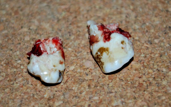 Horse Wolf Teeth (www.Basic-Horse-Care.com) Horse Wolf Teeth (www.Basic-Horse-Care.com)